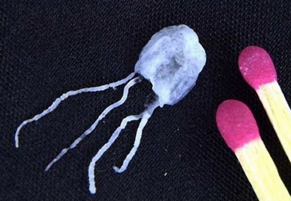 медуза ируканджи